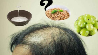 hairloss