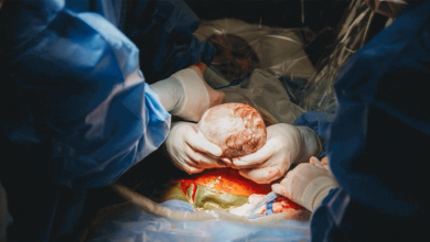 stunning-pics-of-midwife-mom-delivering-her-own-baby-by-c-section