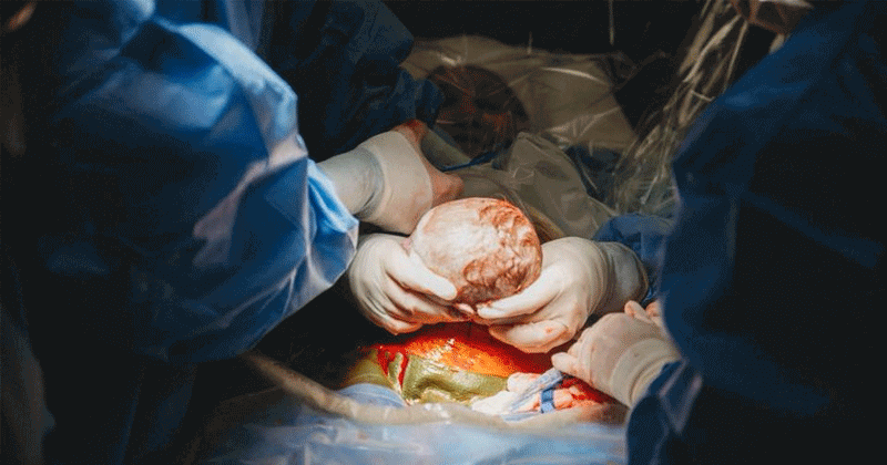 stunning-pics-of-midwife-mom-delivering-her-own-baby-by-c-section