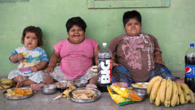 obese children undergo surgery