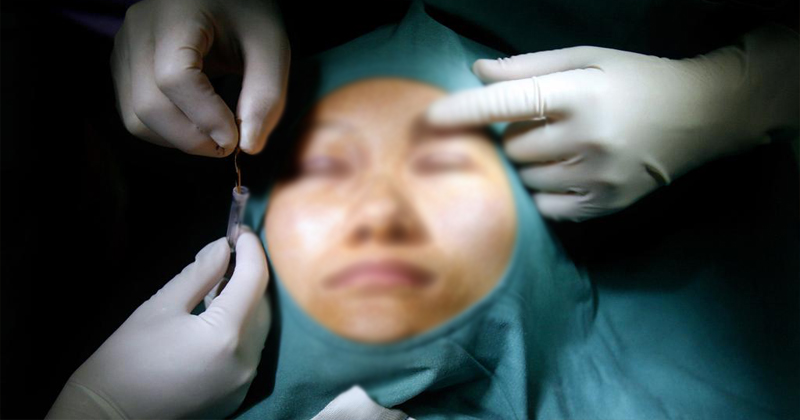 illegal plastic surgery caught in abhudabi